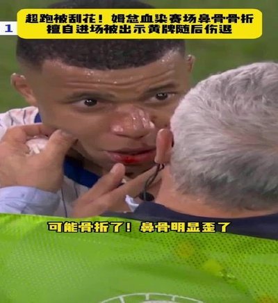 奥莱起底奥地利队：撞断姆巴佩鼻梁的硬汉、身高2米05的巨人