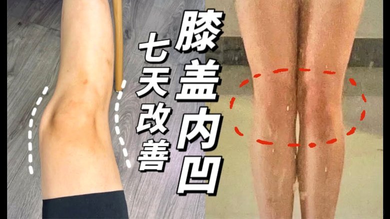 张琳艳双膝重伤，ACL断裂考验女足明星康复之路